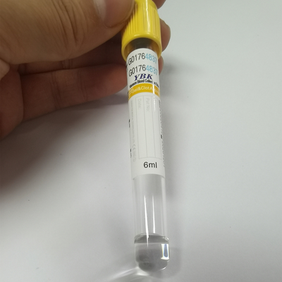 Top amarillo Vacuum del tubo de la colección de la sangre del activador del coágulo de YBK 5ml