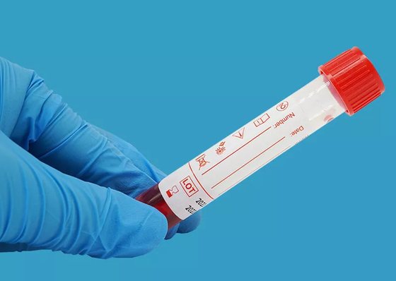 Virus disponible 10ml que muestrea a Kit Nucleic Acid Extraction Kit
