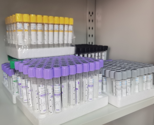 Tubo EDTA de color púrpura con etiqueta violeta para una recolección óptima de muestras