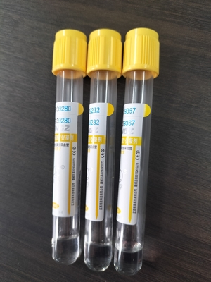 Activador de coágulos de gel estéril superior amarillo SST tubo de recolección de muestras de sangre al vacío para el hospital