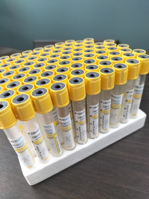 Activador de coágulos de gel estéril superior amarillo SST tubo de recolección de muestras de sangre al vacío para el hospital